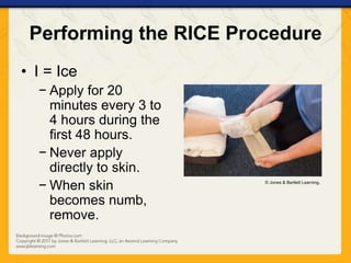Knee Rice Method First Aid Ch15 presentation extremity_injuries | PPTX