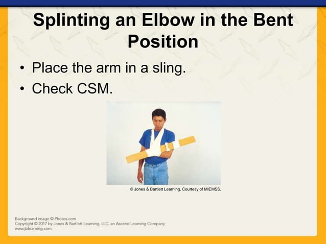 Ch16 presentation splinting_extremities | PPTX | First Aid | Injuries