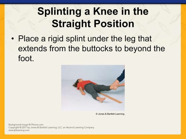Ch16 presentation splinting_extremities | PPTX | First Aid | Injuries