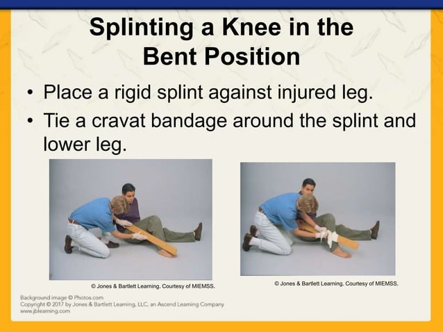 Ch16 presentation splinting_extremities | PPTX | First Aid | Injuries