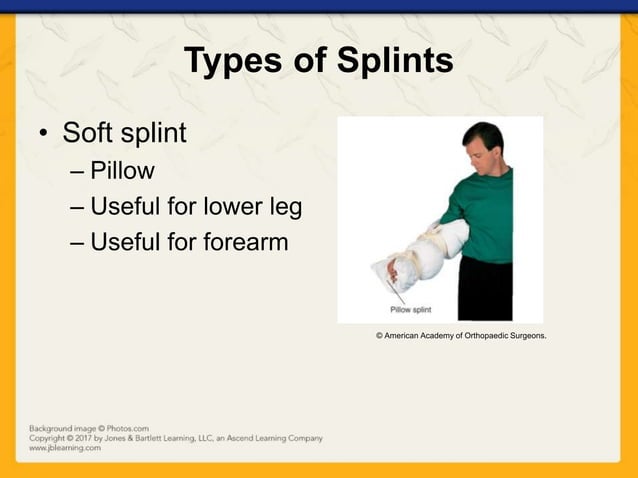 Ch16 presentation splinting_extremities | PPTX | First Aid | Injuries