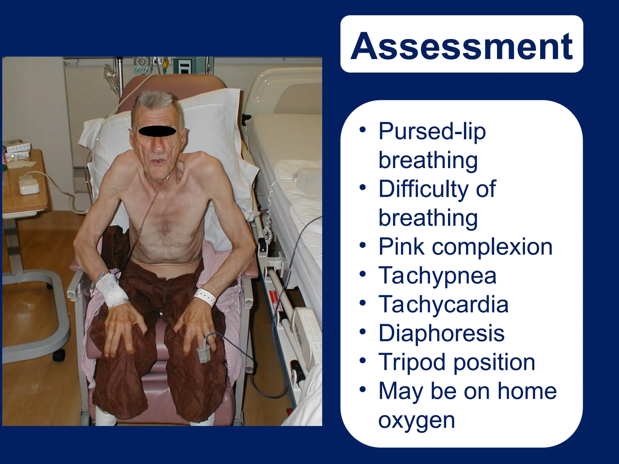 Assessment
• Pursed-lip
breathing
• Difficulty of
breathing
• Pink complexion
• Tachypnea
• Tachycardia
• Diaphoresis
• Tripod position
• May be on home
oxygen
 