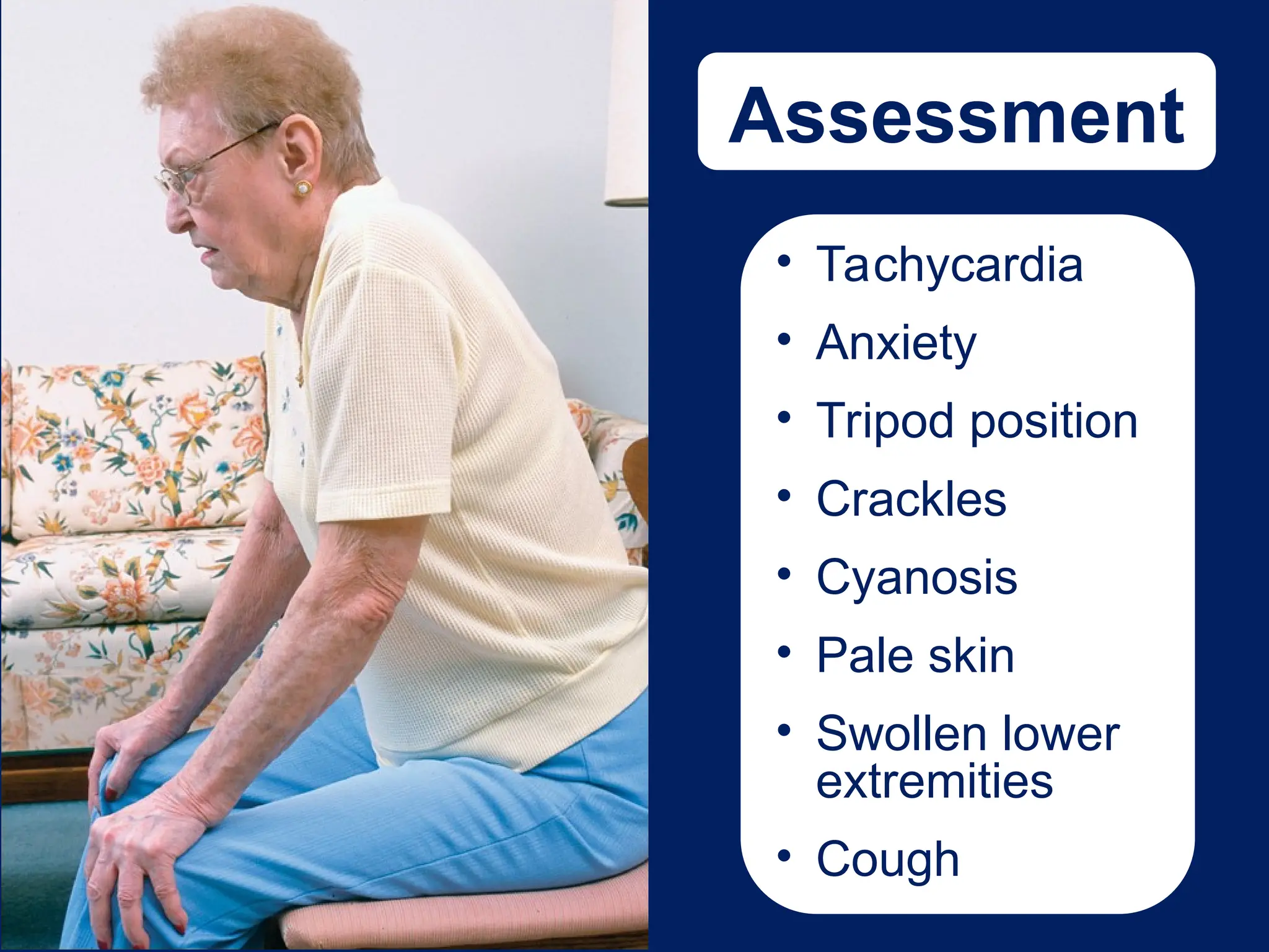 Assessment
• Tachycardia
• Anxiety
• Tripod position
• Crackles
• Cyanosis
• Pale skin
• Swollen lower
extremities
• Cough
 