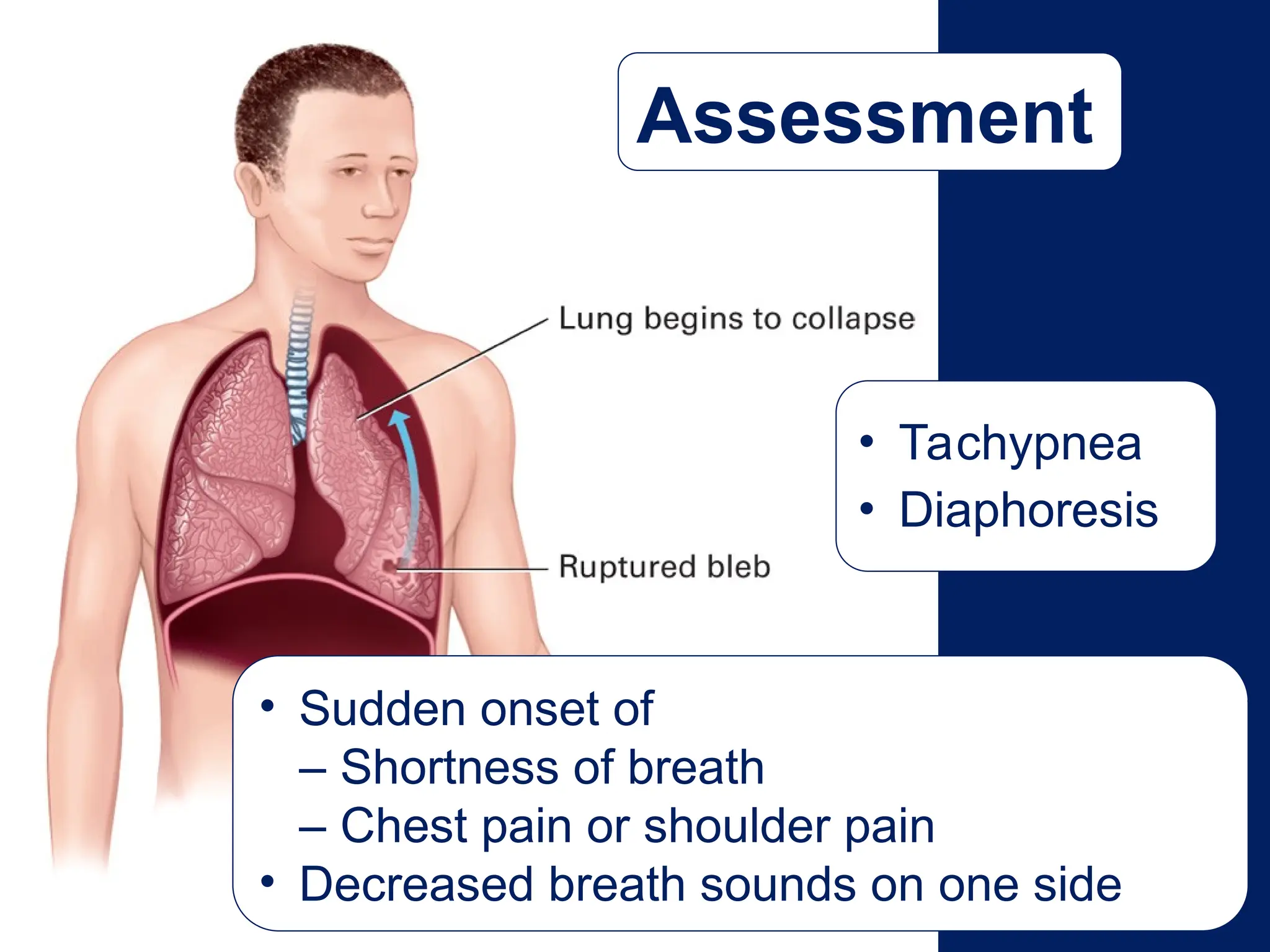 Assessment
• Sudden onset of
– Shortness of breath
– Chest pain or shoulder pain
• Decreased breath sounds on one side
• Tachypnea
• Diaphoresis
 