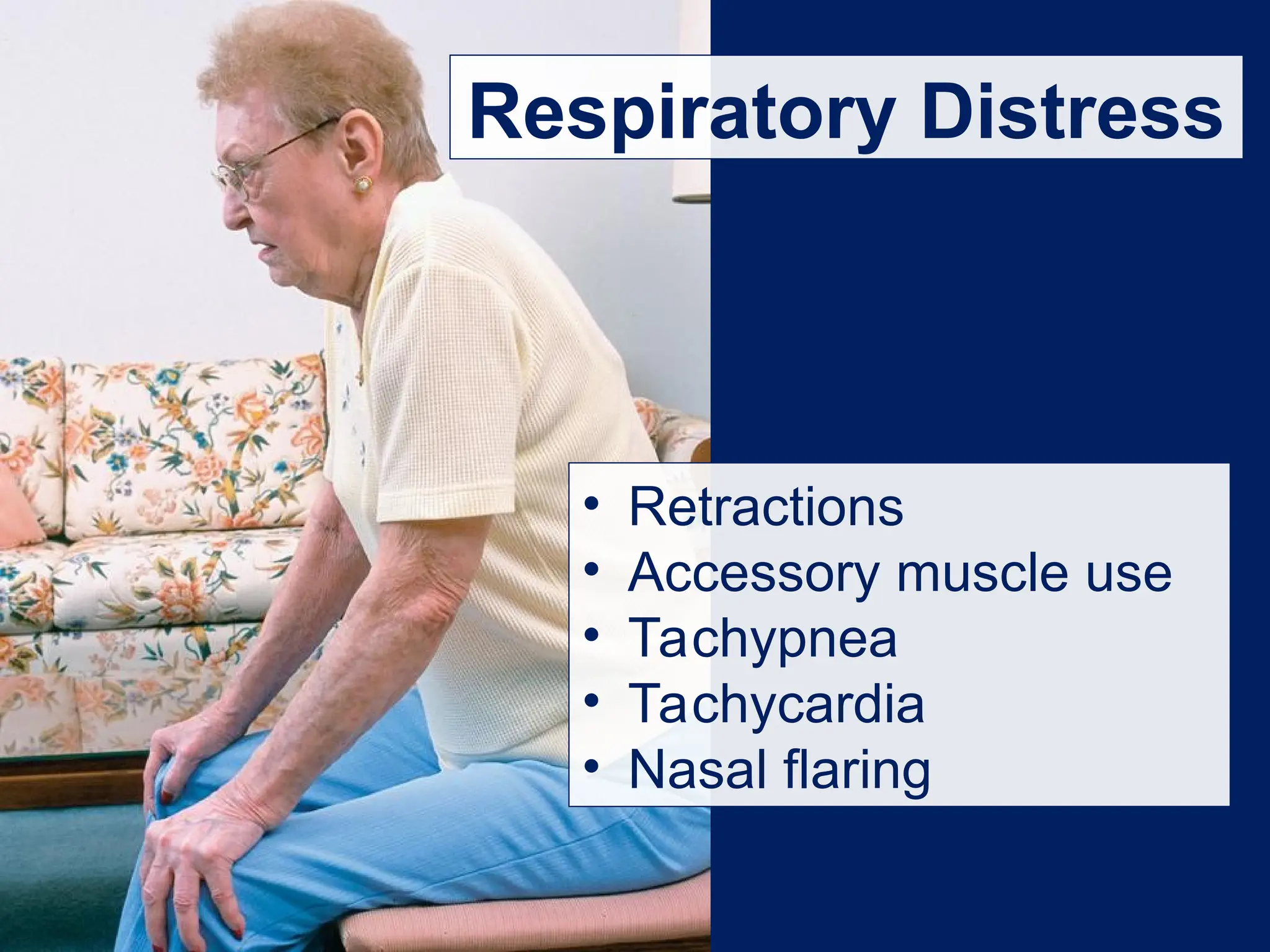Respiratory Distress
• Retractions
• Accessory muscle use
• Tachypnea
• Tachycardia
• Nasal flaring
 