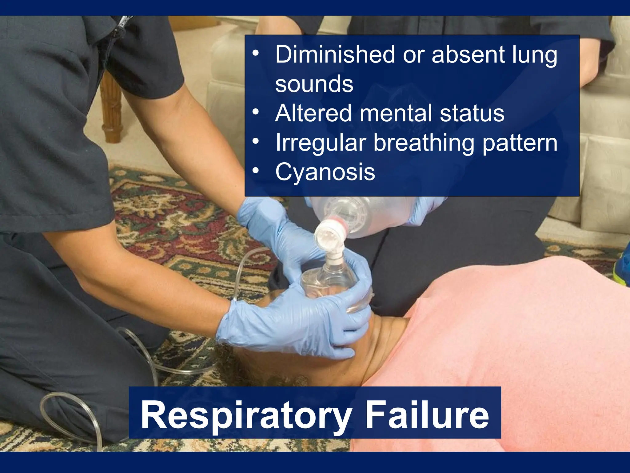 Respiratory Failure
• Diminished or absent lung
sounds
• Altered mental status
• Irregular breathing pattern
• Cyanosis
 