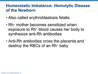 Homeostatic Imbalance: Hemolytic Disease of the Newborn Also called erythroblastosis fetalis Rh –  mother becomes sensitized when exposure to Rh +  blood causes her body to synthesize anti-Rh antibodies Anti-Rh antibodies cross the placenta and destroy the RBCs of an Rh +  baby 