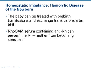 Homeostatic Imbalance: Hemolytic Disease of the Newborn The baby can be treated with prebirth transfusions and exchange transfusions after birth RhoGAM serum containing anti-Rh can prevent the Rh– mother from becoming sensitized 