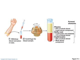 Figure 17.1 1 Withdraw blood and place in tube. 2 Centrifuge the blood sample. Plasma •  55% of whole blood •  Least dense component Buffy coat •  Leukocytes and platelets •  <1% of whole blood Erythrocytes •  45% of whole blood •  Most dense component Formed elements 
