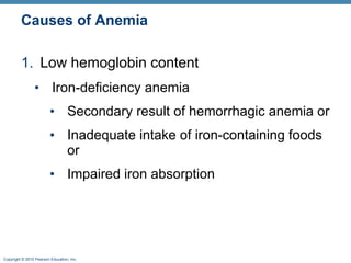 Causes of Anemia Low hemoglobin content Iron-deficiency anemia  Secondary result of hemorrhagic anemia or Inadequate intake of iron-containing foods or Impaired iron absorption 