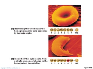 Figure 17.8 1 2 3 4 5 6 7 146 1 2 3 4 5 6 7 146 (a) Normal erythrocyte has normal hemoglobin amino acid sequence in the beta chain. (b) Sickled erythrocyte results from a single amino acid change in the beta chain of hemoglobin. 