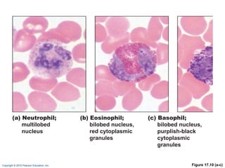 Figure 17.10 (a-c) (a) Neutrophil; multilobed nucleus (b) Eosinophil; bilobed nucleus,  red cytoplasmic  granules (c) Basophil; bilobed nucleus, purplish-black  cytoplasmic  granules 