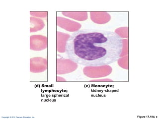 Figure 17.10d, e (d) Small lymphocyte; large spherical  nucleus (e) Monocyte; kidney-shaped nucleus 