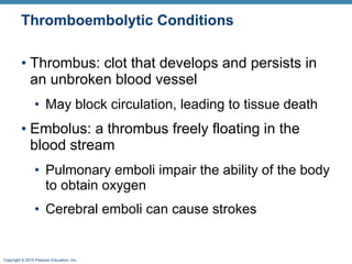 Thromboembolytic Conditions Thrombus: clot that develops and persists in an unbroken blood vessel May block circulation, leading to tissue death Embolus: a thrombus freely floating in the blood stream Pulmonary emboli impair the ability of the body to obtain oxygen Cerebral emboli can cause strokes 