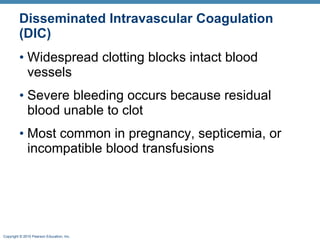 Disseminated Intravascular Coagulation (DIC) Widespread clotting blocks intact blood vessels Severe bleeding occurs because residual blood unable to clot Most common in pregnancy, septicemia, or incompatible blood transfusions 