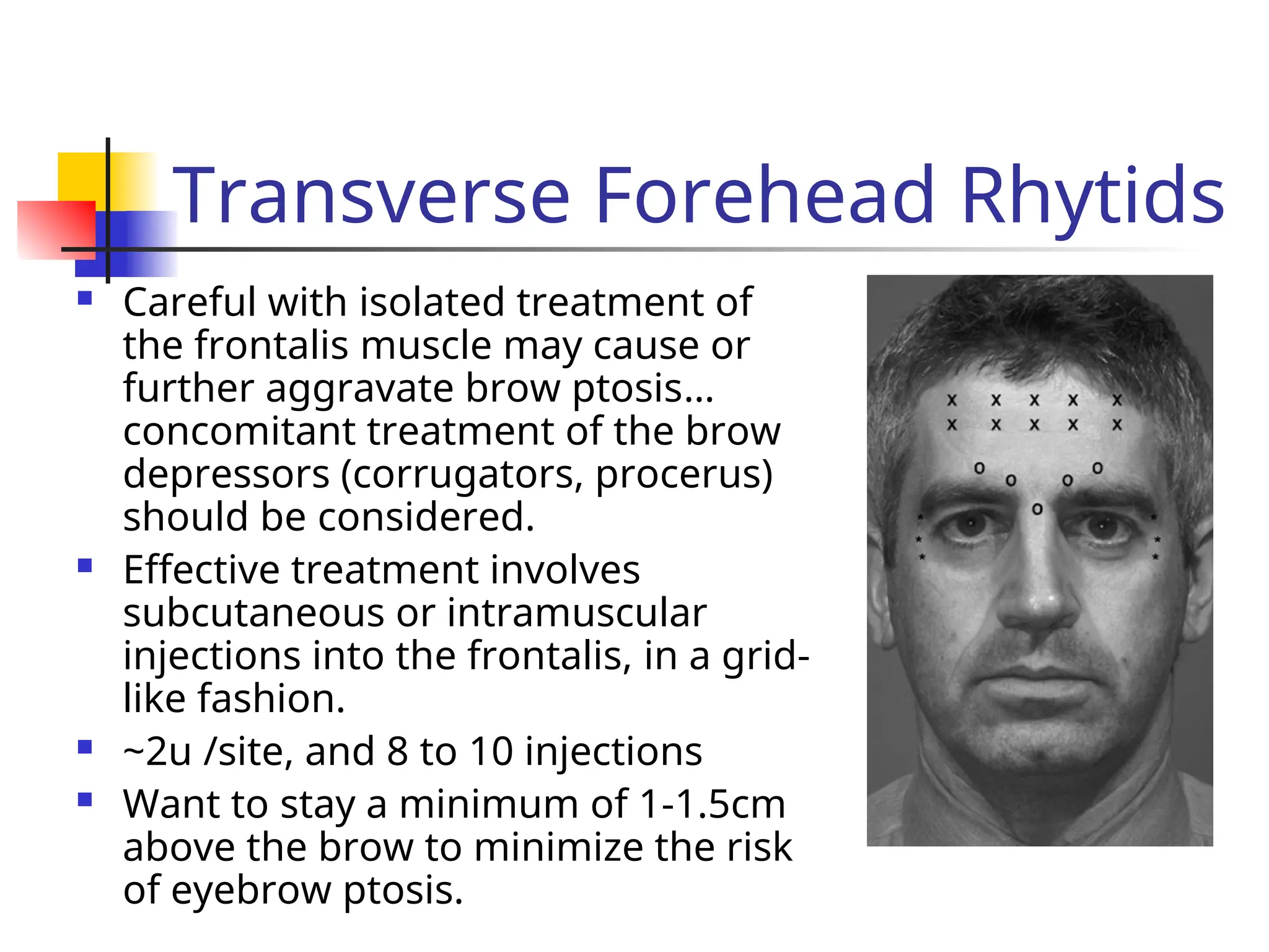 Transverse Forehead Rhytids
 Careful with isolated treatment of
the frontalis muscle may cause or
further aggravate brow ptosis…
concomitant treatment of the brow
depressors (corrugators, procerus)
should be considered.
 Effective treatment involves
subcutaneous or intramuscular
injections into the frontalis, in a grid-
like fashion.
 ~2u /site, and 8 to 10 injections
 Want to stay a minimum of 1-1.5cm
above the brow to minimize the risk
of eyebrow ptosis.
 