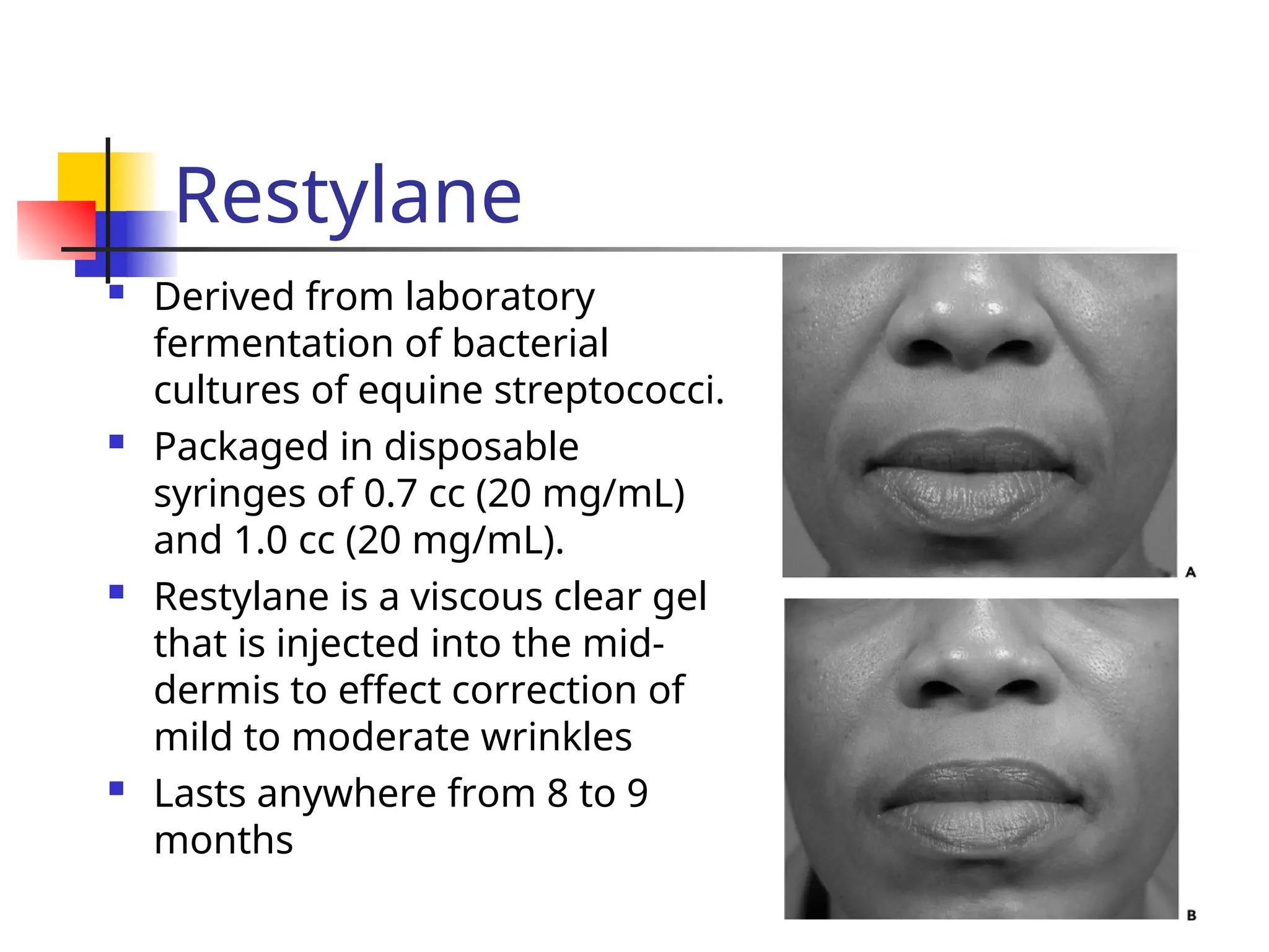 Restylane
 Derived from laboratory
fermentation of bacterial
cultures of equine streptococci.
 Packaged in disposable
syringes of 0.7 cc (20 mg/mL)
and 1.0 cc (20 mg/mL).
 Restylane is a viscous clear gel
that is injected into the mid-
dermis to effect correction of
mild to moderate wrinkles
 Lasts anywhere from 8 to 9
months
 