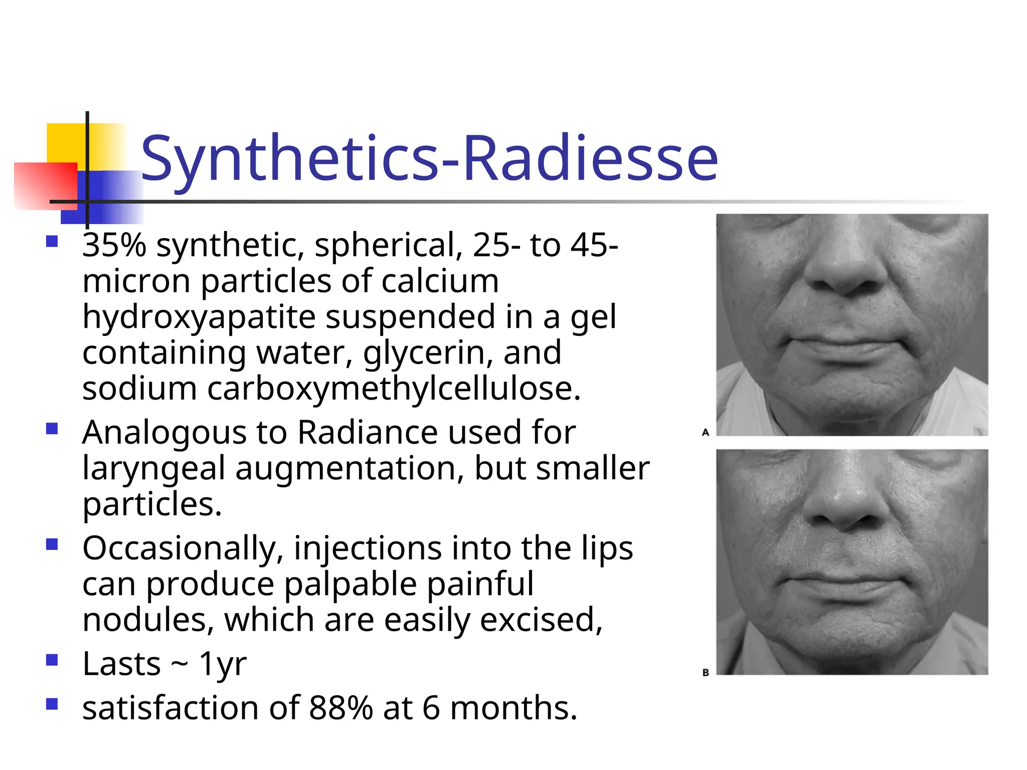 Synthetics-Radiesse
 35% synthetic, spherical, 25- to 45-
micron particles of calcium
hydroxyapatite suspended in a gel
containing water, glycerin, and
sodium carboxymethylcellulose.
 Analogous to Radiance used for
laryngeal augmentation, but smaller
particles.
 Occasionally, injections into the lips
can produce palpable painful
nodules, which are easily excised,
 Lasts ~ 1yr
 satisfaction of 88% at 6 months.
 