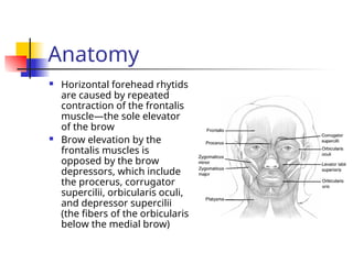 Ch 185 - Cosmetic Uses of Botox and Injectable Fillers.ppt
