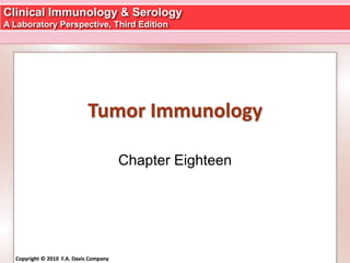 Clinical Immunology & Serology
A Laboratory Perspective, Third Edition
Copyright © 2010 F.A. Davis CompanyCopyright © 2010 F.A. Davis Company
Tumor Immunology
Chapter Eighteen
 