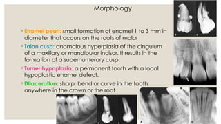 Sharp Linear Defect Tooth White and Pharoah Oral Radiology Ch 19-21.pptx