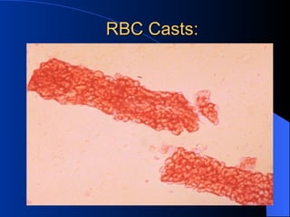 kidneys pathology of chapter nineteen ppt | PPT