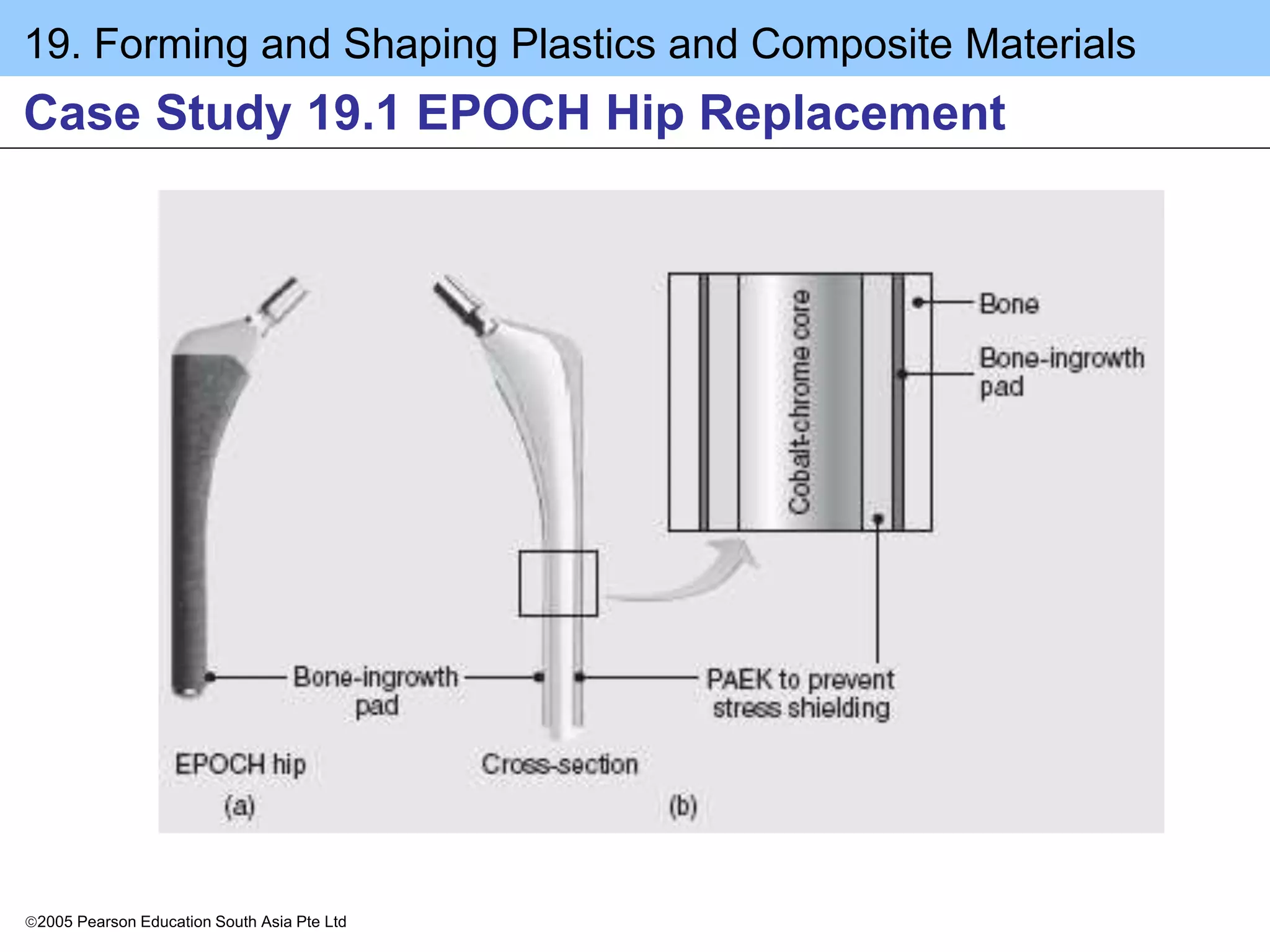 19. Forming and Shaping Plastics and Composite Materials
2005 Pearson Education South Asia Pte Ltd
Case Study 19.1 EPOCH Hip Replacement
 