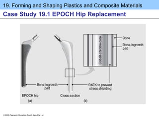 19. Forming and Shaping Plastics and Composite Materials
2005 Pearson Education South Asia Pte Ltd
Case Study 19.1 EPOCH Hip Replacement
 
