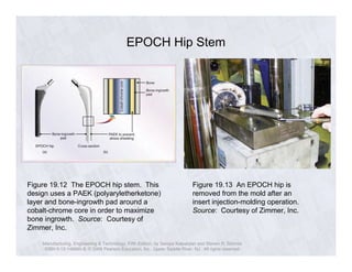 EPOCH Hip Stem 
Figure 19.12 The EPOCH hip stem. This 
design uses a PAEK (polyaryletherketone) 
layer and bone-ingrowth pad around a 
cobalt-chrome core in order to maximize 
bone ingrowth. Source: Courtesy of 
Zimmer, Inc. 
Figure 19.13 An EPOCH hip is 
removed from the mold after an 
insert injection-molding operation. 
Source: Courtesy of Zimmer, Inc. 
Manufacturing, Engineering & Technology, Fifth Edition, by Serope Kalpakjian and Steven R. Schmid. 
ISBN 0-13-148965-8. © 2006 Pearson Education, Inc., Upper Saddle River, NJ. All rights reserved. 
 