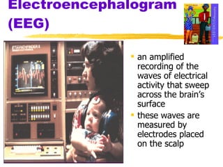 Electroencephalogram (EEG) an amplified recording of the waves of electrical activity that sweep across the brain’s surface these waves are measured by electrodes placed on the scalp 