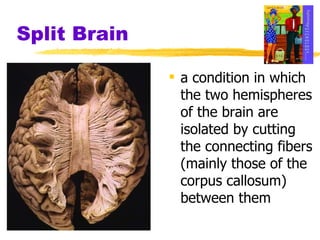 Split Brain a condition in which the two hemispheres of the brain are isolated by cutting the connecting fibers (mainly those of the corpus callosum) between them 