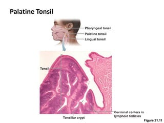 Tonsil
Tonsillar crypt
Germinal centers in
lymphoid follicles
Pharyngeal tonsil
Palatine tonsil
Lingual tonsil
Palatine Tonsil
Figure 21.11
 