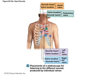 © 2012 Pearson Education, Inc.
Figure 20-18a Heart Sounds
Aortic
valve
Pulmonary
valve
Valve location
Sounds heard
Left
AV
valve
Right
AV
valve
Placements of a stethoscope for
listening to the different sounds
produced by individual valves
Valve location
Sounds heard
Valve location
Sounds heard
Valve location
Sounds heard
 