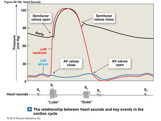 © 2012 Pearson Education, Inc.
Figure 20-18b Heart Sounds
Semilunar
valves close
AV valves
open
AV valves
close
“Dubb”“Lubb”
The relationship between heart sounds and key events in the
cardiac cycle
Heart sounds
Pressure
(mmHg)
Aorta
Semilunar
valves open
Left
ventricle
Left
atrium
S1
S4S4
S2
S3
 