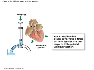 © 2012 Pearson Education, Inc.
Figure 20-19 A Simple Model of Stroke Volume
Pumping
As the pump handle is
pushed down, water is forced
out of the cylinder. This cor-
responds to the period of
ventricular ejection.
Ventricular
systole
 