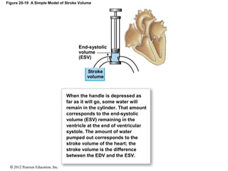 © 2012 Pearson Education, Inc.
Figure 20-19 A Simple Model of Stroke Volume
When the handle is depressed as
far as it will go, some water will
remain in the cylinder. That amount
corresponds to the end-systolic
volume (ESV) remaining in the
ventricle at the end of ventricular
systole. The amount of water
pumped out corresponds to the
stroke volume of the heart; the
stroke volume is the difference
between the EDV and the ESV.
Stroke
volume
End-systolic
volume
(ESV)
 