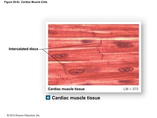 © 2012 Pearson Education, Inc.
Figure 20-5c Cardiac Muscle Cells
Intercalated discs
Cardiac muscle tissue
Cardiac muscle tissue LM × 575
 