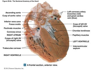 © 2012 Pearson Education, Inc.
Figure 20-6c The Sectional Anatomy of the Heart
A frontal section, anterior view.
Inferior vena cava
RIGHT VENTRICLE
Papillary muscles
Cusps of right AV
(tricuspid) valve
Pectinate muscles
RIGHT ATRIUM
Fossa ovalis
Ascending aorta
Cusp of left AV
(bicuspid) valve
Interventricular
septum
LEFT VENTRICLE
Chordae tendineae
Left coronary artery
branches (red)
and great cardiac
vein (blue)
Cusp of aortic valve
Coronary sinus
Trabeculae carneae
 