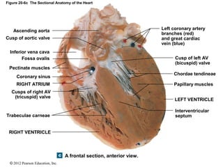 © 2012 Pearson Education, Inc.
Figure 20-6c The Sectional Anatomy of the Heart
A frontal section, anterior view.
Inferior vena cava
RIGHT VENTRICLE
Papillary muscles
Cusps of right AV
(tricuspid) valve
Pectinate muscles
RIGHT ATRIUM
Fossa ovalis
Ascending aorta
Cusp of left AV
(bicuspid) valve
Interventricular
septum
LEFT VENTRICLE
Chordae tendineae
Left coronary artery
branches (red)
and great cardiac
vein (blue)
Cusp of aortic valve
Coronary sinus
Trabeculae carneae
 