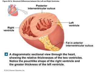 © 2012 Pearson Education, Inc.
Figure 20-7a Structural Differences between the Left and Right Ventricles
Left
ventricle
Right
ventricle
Posterior
interventricular sulcus
Fat in anterior
interventricular sulcus
A diagrammatic sectional view through the heart,
showing the relative thicknesses of the two ventricles.
Notice the pouchlike shape of the right ventricle and
the greater thickness of the left ventricle.
 