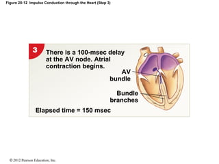 © 2012 Pearson Education, Inc.
Figure 20-12 Impulse Conduction through the Heart (Step 3)
Elapsed time = 150 msec
Bundle
branches
AV
bundle
There is a 100-msec delay
at the AV node. Atrial
contraction begins.
 