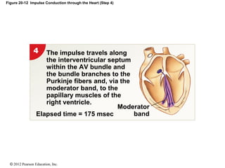 © 2012 Pearson Education, Inc.
Figure 20-12 Impulse Conduction through the Heart (Step 4)
Elapsed time = 175 msec
Moderator
band
The impulse travels along
the interventricular septum
within the AV bundle and
the bundle branches to the
Purkinje fibers and, via the
moderator band, to the
papillary muscles of the
right ventricle.
 