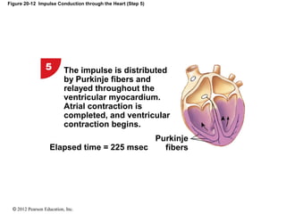 © 2012 Pearson Education, Inc.
Figure 20-12 Impulse Conduction through the Heart (Step 5)
Elapsed time = 225 msec
Purkinje
fibers
The impulse is distributed
by Purkinje fibers and
relayed throughout the
ventricular myocardium.
Atrial contraction is
completed, and ventricular
contraction begins.
 
