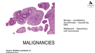 MALE AND FEMALE GENITAL TRACT | PPTX