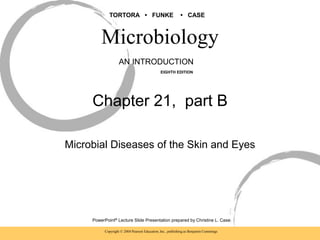 Copyright © 2004 Pearson Education, Inc., publishing as Benjamin Cummings
PowerPoint® Lecture Slide Presentation prepared by Christine L. Case
Microbiology
AN INTRODUCTION
EIGHTH EDITION
TORTORA • FUNKE • CASE
Chapter 21, part B
Microbial Diseases of the Skin and Eyes
 