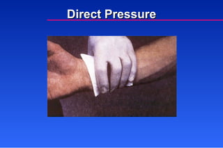 Bleeding and Shock | PPT