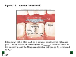 21-57
Figure 21.9 A dental “voltaic cell.”
Biting down with a filled tooth on a scrap of aluminum foil will cause
pain. The foil acts as an active anode (E°aluminum = -1.66 V), saliva as
the electrolyte, and the filling as an inactive cathode as O2 is reduced
to H2O.
 