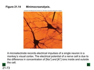 21-73
Figure 21.14 Minimocroanalysis.
A microelectrode records electrical impulses of a single neuron in a
monkey’s visual cortex. The electrical potential of a nerve cell is due to
the difference in concentration of [Na+] and [K+] ions inside and outside
the cell.
 