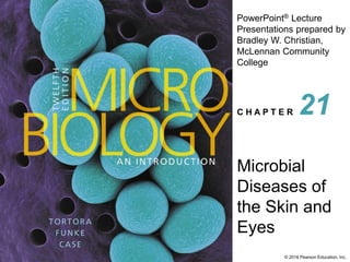 PowerPoint® Lecture
Presentations prepared by
Bradley W. Christian,
McLennan Community
College
C H A P T E R
© 2016 Pearson Education, Inc.
Microbial
Diseases of
the Skin and
Eyes
21
 