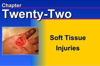 Chapter Soft Tissue  Injuries Twenty-Two 